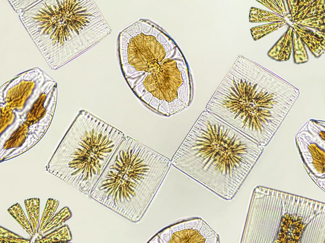 Diatoms